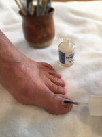 CurveCorrect Ingrown Nail Treatment Kit